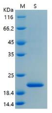 SDS-PAGE (NCR2-188H).jpg